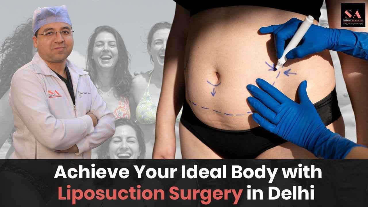Achieve Your Ideal Body with Liposuction Surgery in Delhi