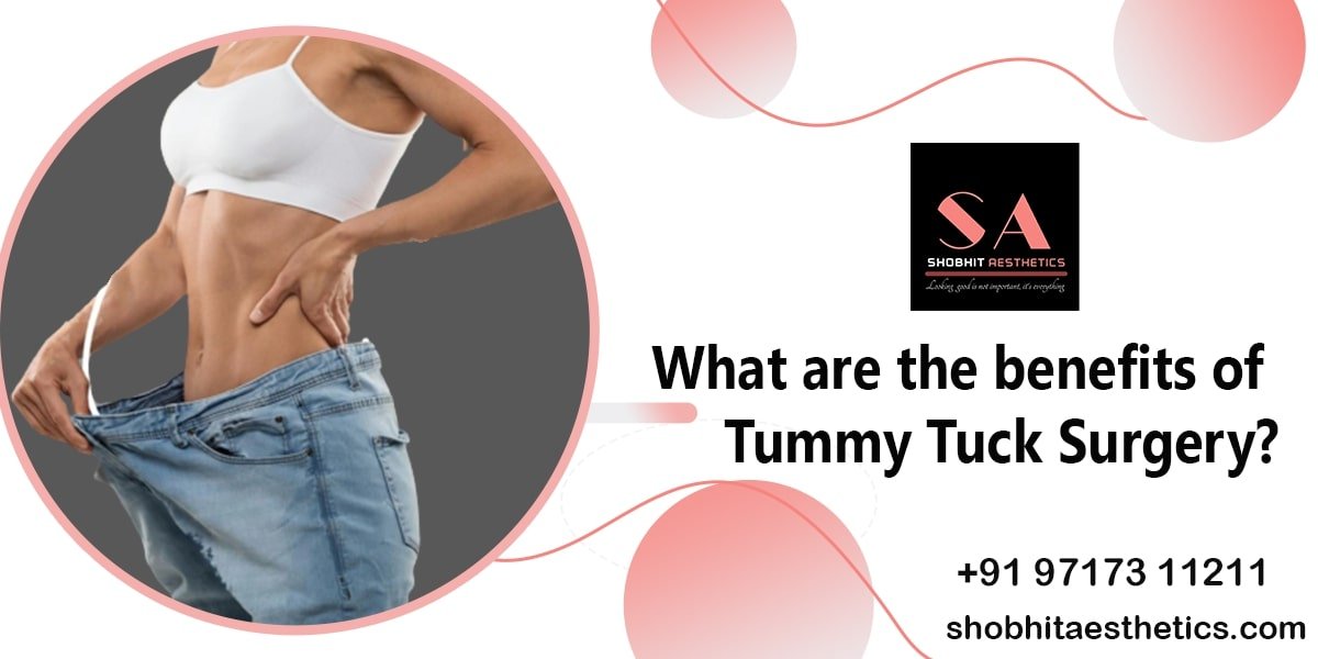 What are the Benefits of Tummy Tuck Surgery?