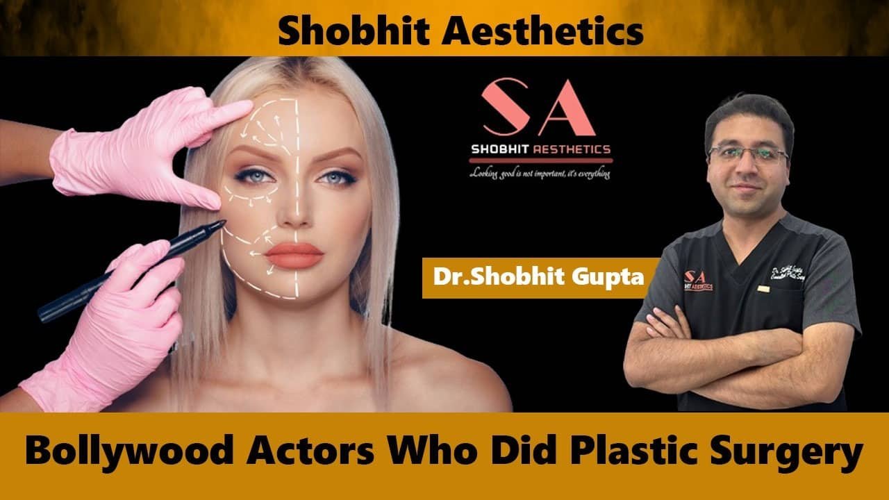 Bollywood Actors Who Did Plastic Surgery?