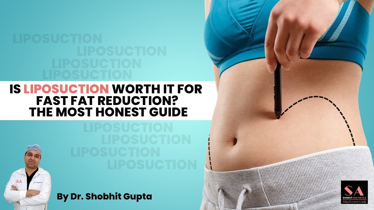 Is Liposuction Worth It for Fast Fat Reduction? The Most Honest Guide by Dr. Shobhit Gupta