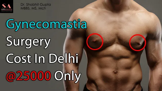 How Much Does Gynecomastia Surgery Cost in Delhi, India?