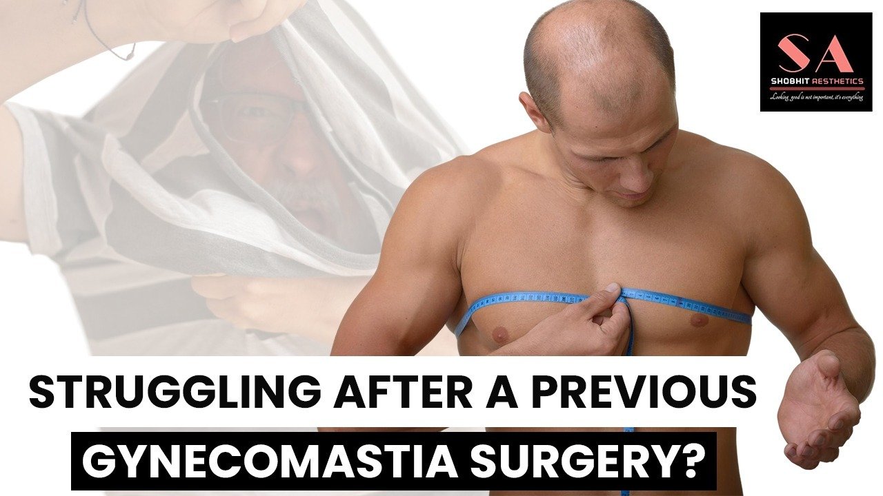 Struggling After a Previous Gynecomastia Surgery?