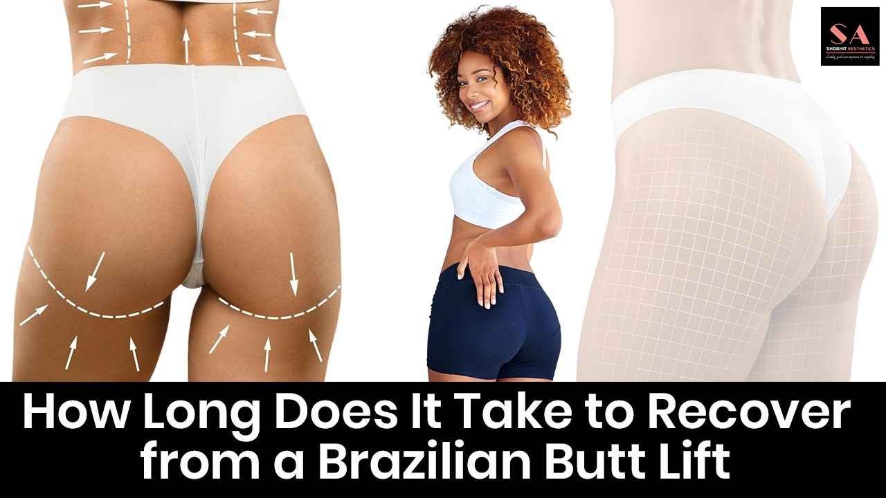 How Long Does It Take to Recover from a Brazilian Butt Lift