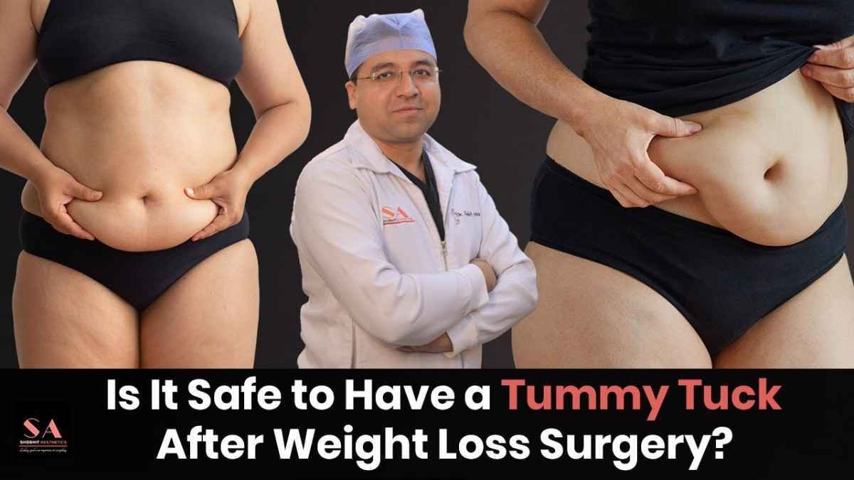 Is It Safe to Have a Tummy Tuck After Weight Loss Surgery?
