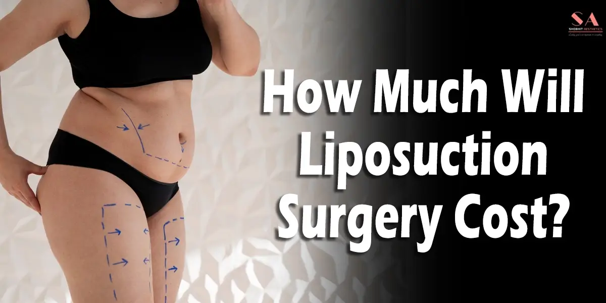 How much will Liposuction surgery cost in Delhi, India