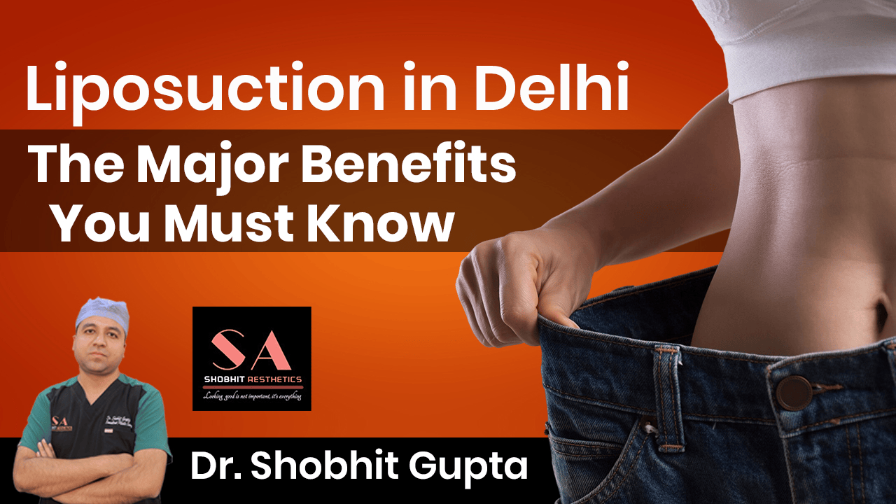 Liposuction in Delhi: The Major Benefits You Must Know