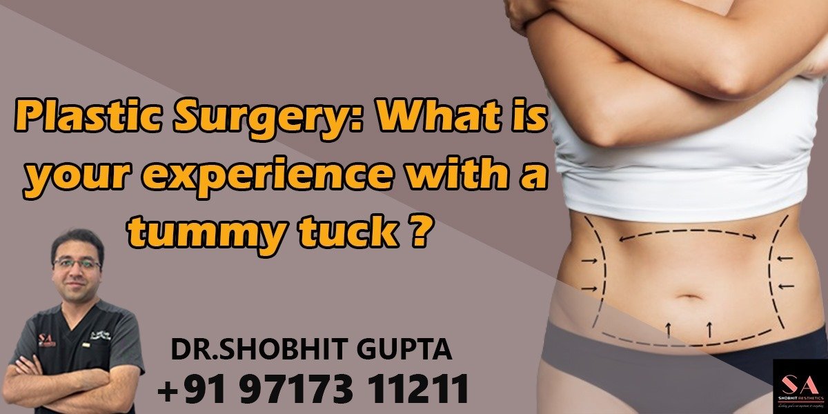 Plastic Surgеry: What is Your Experience with a Tummy Tuck?