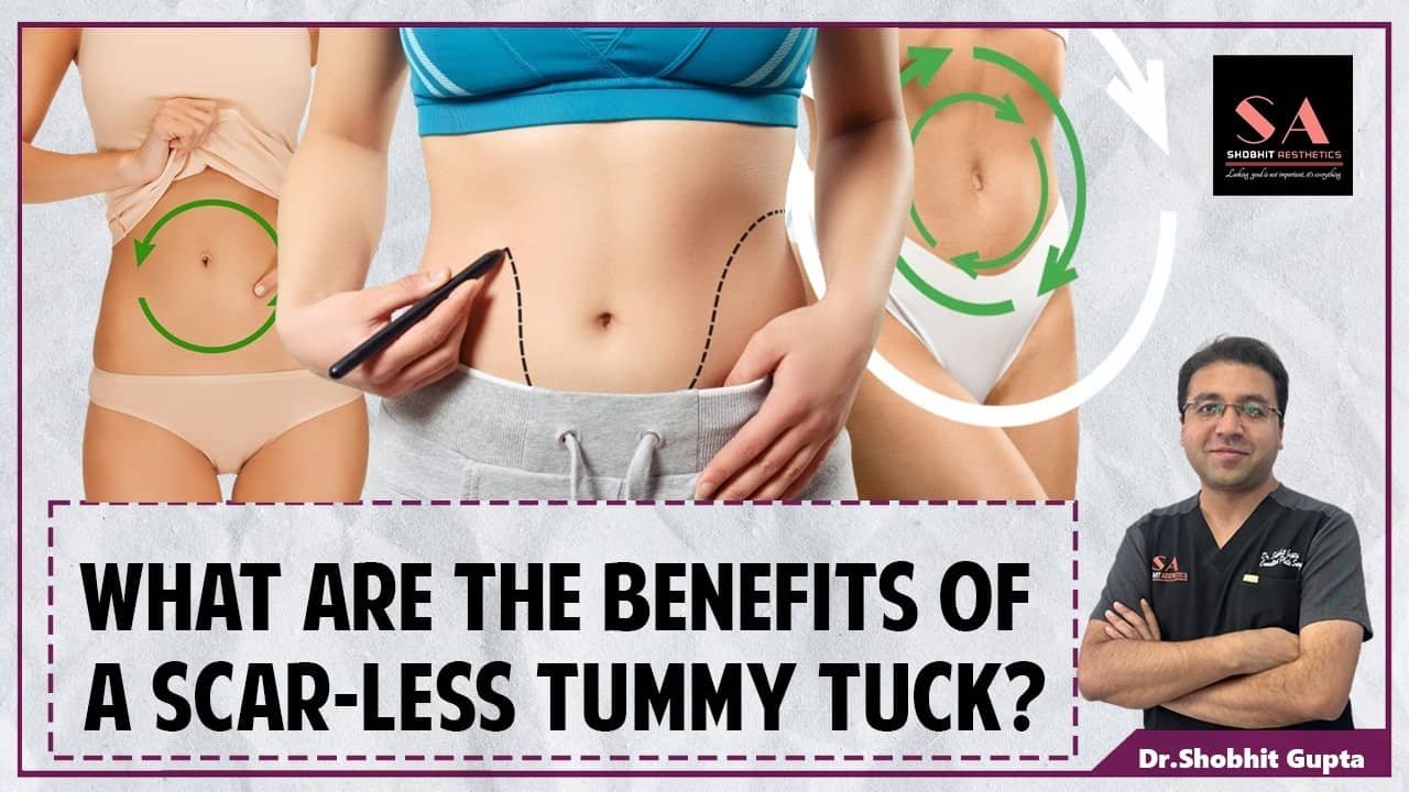 What Are the Benefits of a Scarless Tummy Tuck