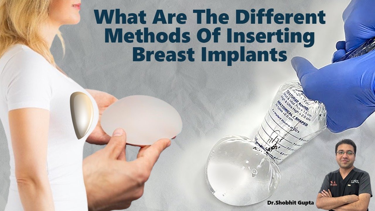 What are the Different Methods of Inserting Breast Implants?
