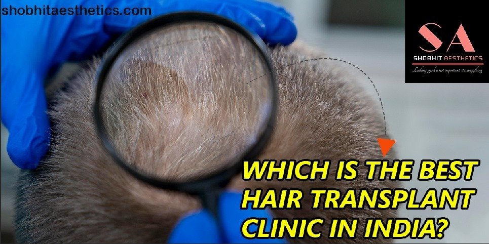 Which Is the Best Hair Transplant Clinic in India?