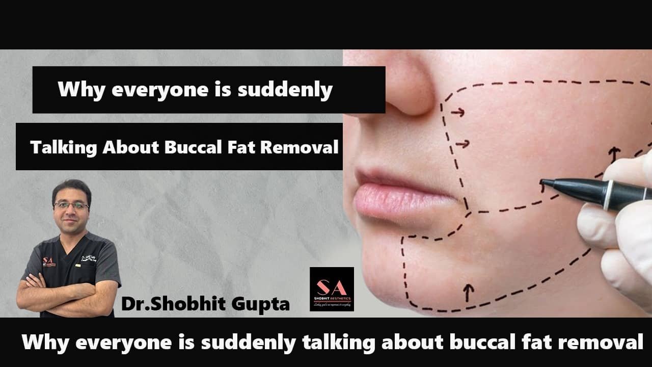 Why Everyone is Suddenly Talking About Buccal Fat Removal