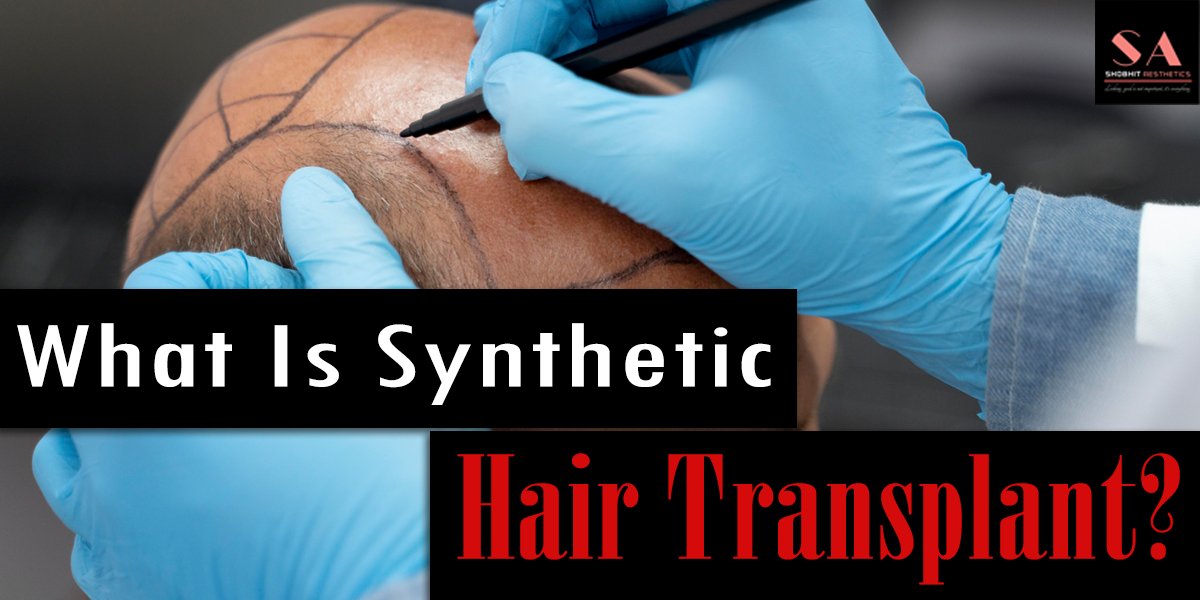 What Is Synthetic Hair Transplant? Significance of Synthetic Implantation